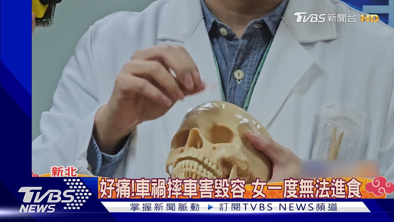 臉骨拼圖！　上下顎斷10截2醫聯手恢復容貌