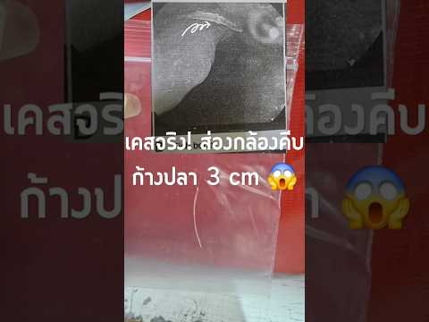 คลิกเพื่อดูคลิปวิดีโอ