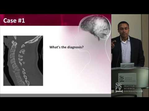 Cervical Spine Trauma- Operative and Non-Operative Management - David O. Okonkwo, MD, PhD