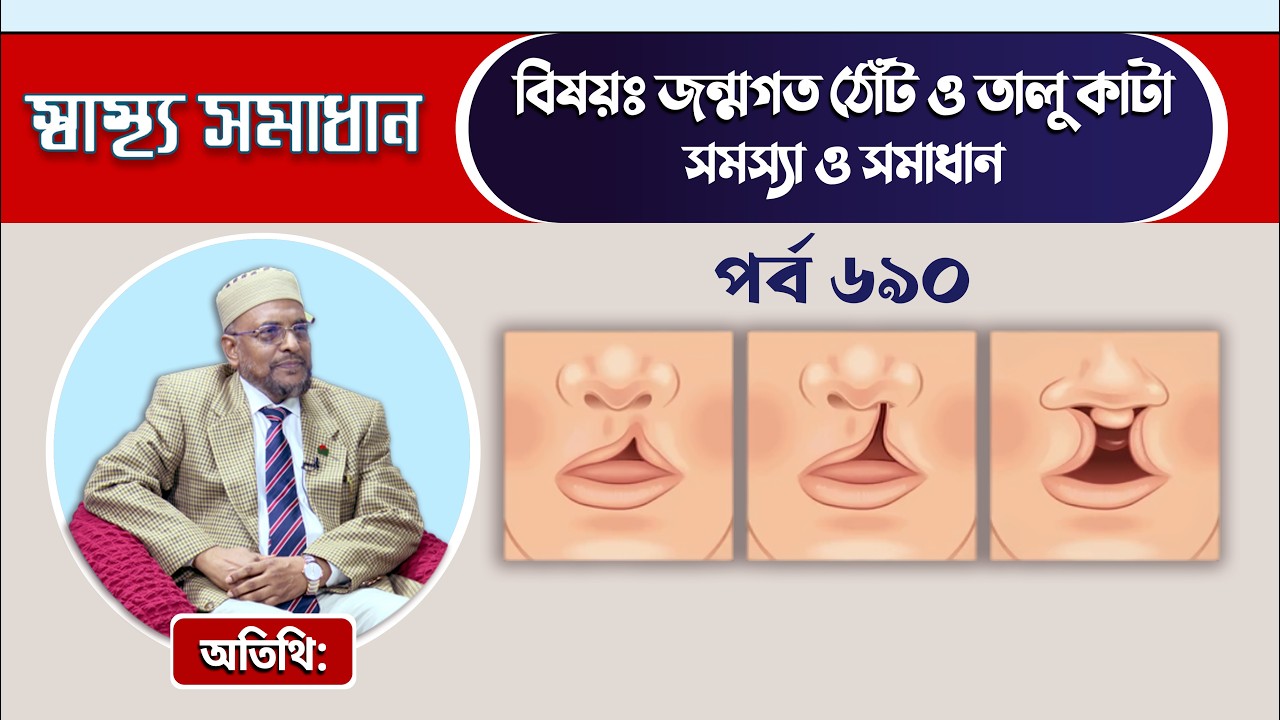জন্মগত ঠোঁট ও তালু কাটা: সমস্যা ও সমাধান
