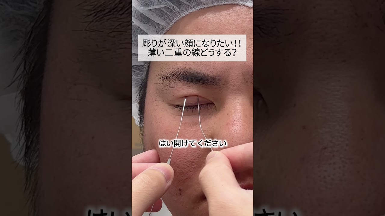Youtubeのサムネイル