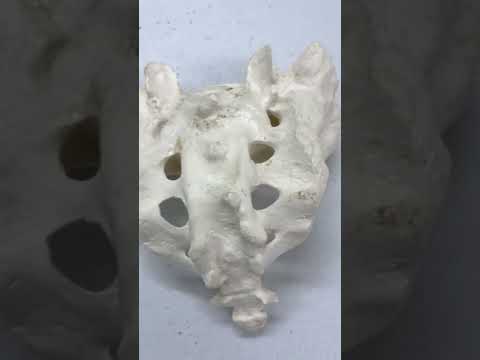 SACRUM - Clinical Functional and Developmental Aspects - Sanjoy Sanyal