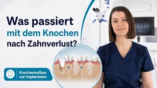 Was ist Knochenaufbau?