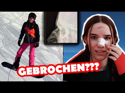 SKIURLAUB endet im KRANKENHAUS😳😨 @itsmanjuu