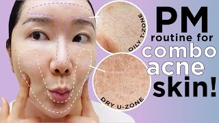 PM Skincare Routine for clearing acne! Oily T-zone & Dry U-Zone Acne Sensitive Skin!