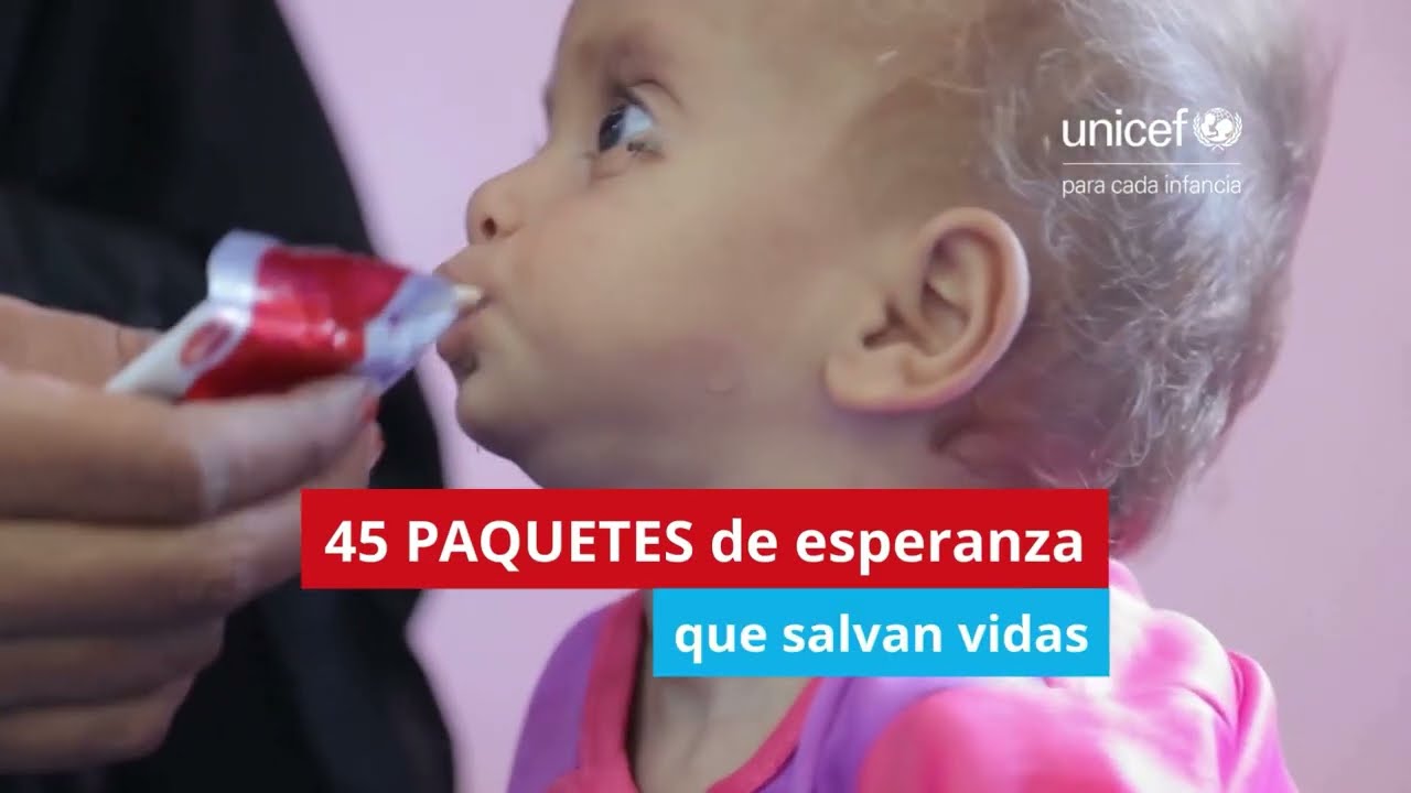 Semáforo de desnutrición aguda 2