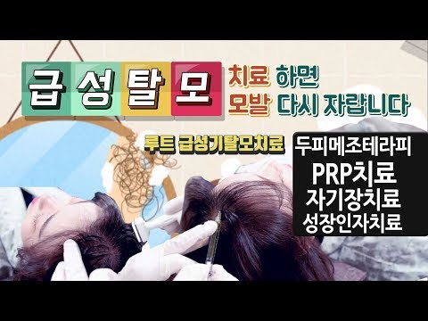 급성 대량탈모치료 메조테라피 PRP 성장인자 자기장치료 루트탈모치료