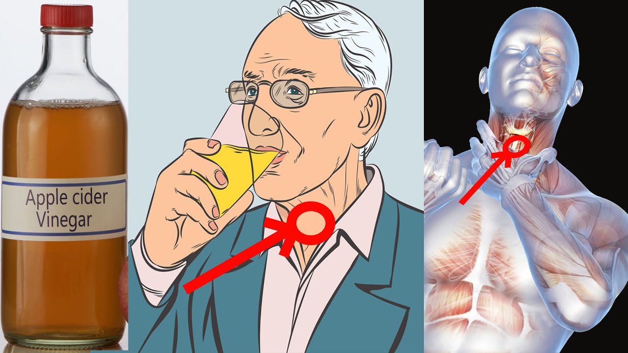 This Will Happen If You Start Using Apple Cider Vinegar Everyday