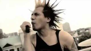 The Casualties We Are All We Have Video