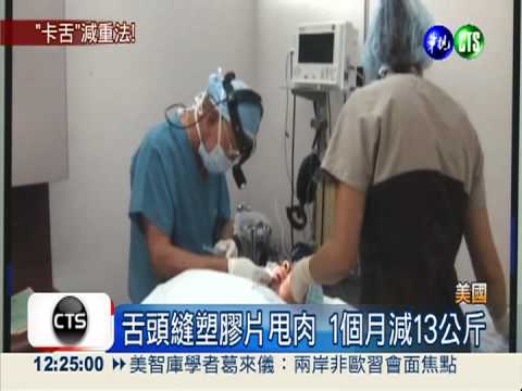 超變態減重! 舌頭縫塑膠片甩肉