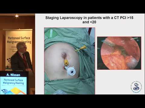 A Nissan - CRS plus Hipec for colorectal cancer