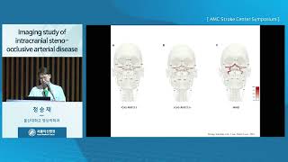 2025년 서울아산병원 뇌졸중 심포지엄 : Imaging study of intracranial steno-occlusive arterial disease 미리보기