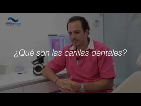 ¿Qué son las carillas dentales?