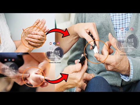 Nese vazhdimisht keni mpirje te gjymtyrëve: Ju mund te vuani nga keto sëmundje