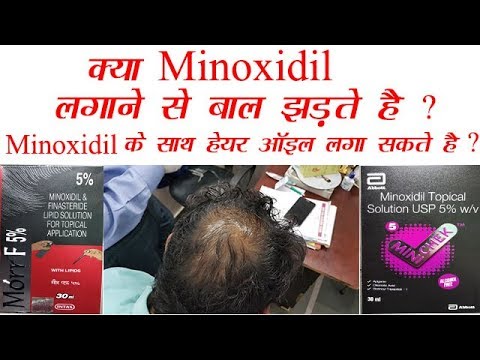 Hair loss after minoxidil use/ use of hair oil after applyin...
