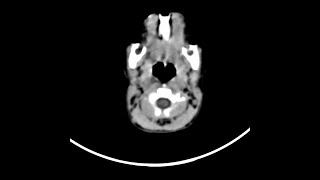 Case of the Day - 15 Nov 24