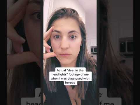 Actual footage of being diagnosed with herpes