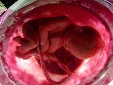 Click to Watch the Example of the Throwaway Culture of Pope Francis: Aborted Babies Burned for Heat in British Hospitals  video Click to Watch the Example of the Throwaway Culture of Pope Francis: Aborted Babies Burned for Heat in British Hospitals  video