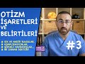 Otizm'in İşaretleri Ve Belirtileri #3