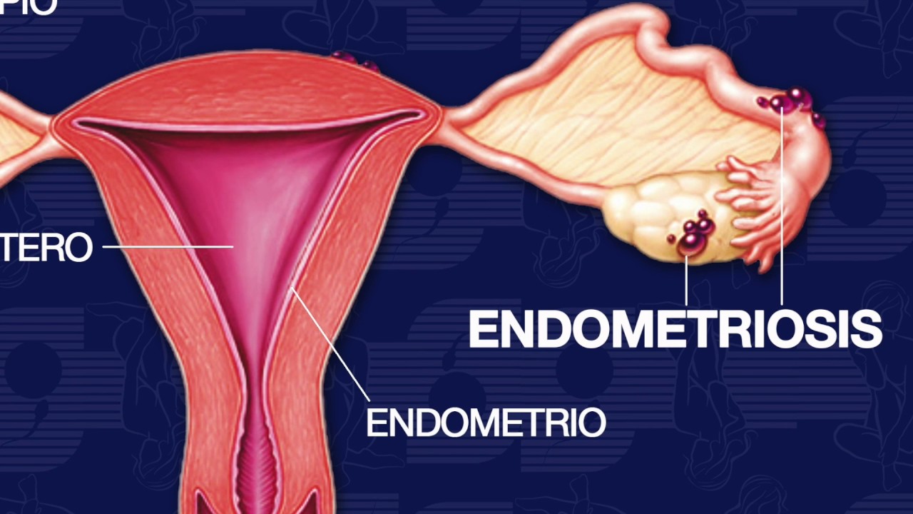 Ruben Tlapanco Vargas-21