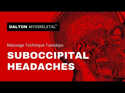 Relieving Suboccipital Headaches with Trigger Point Therapy with Erik Dalton