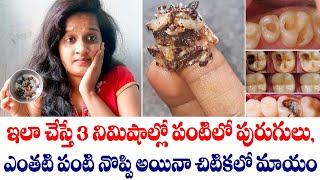 Download lagu Toothache Remedies | Home Remedies For Toothache | Panti noppi | Teeth Pain mp3