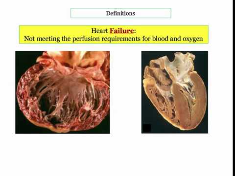 12DaysinMarch, Heart Failure (1): Introduction for the USMLE Step One Exam