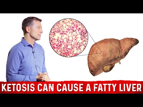 What is a Ketone Explained By Dr Berg