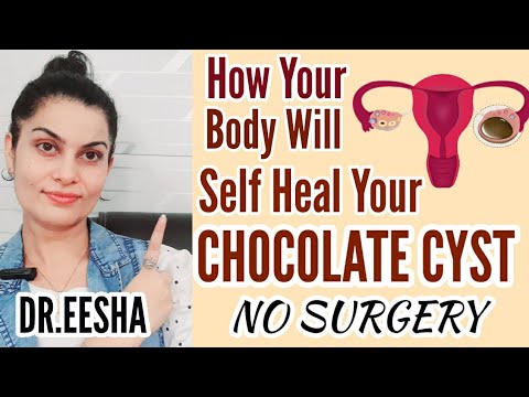 How To Enhance Autophagy And Shrink Chocolate Cyst Automatically|DR.EESHA ARORA| Whatsapp 9814955510