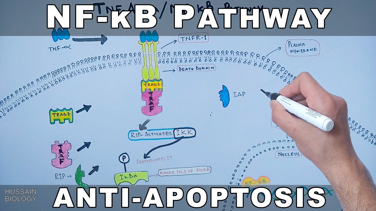 Multiple myeloma kappa light chain