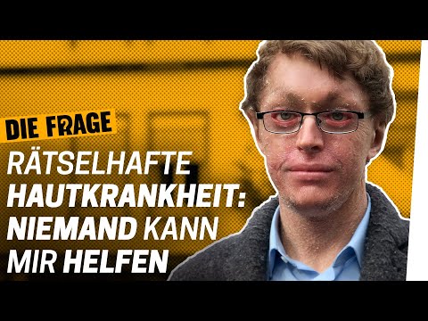 Rare Disease: My Life Without a Cure | How Do I Live with a Serious Illness? Episode 7