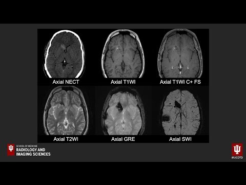 Brain Case of the Day 27