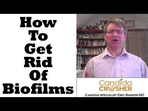 How To Get RID Of Biofilms | Ask Eric Bakker