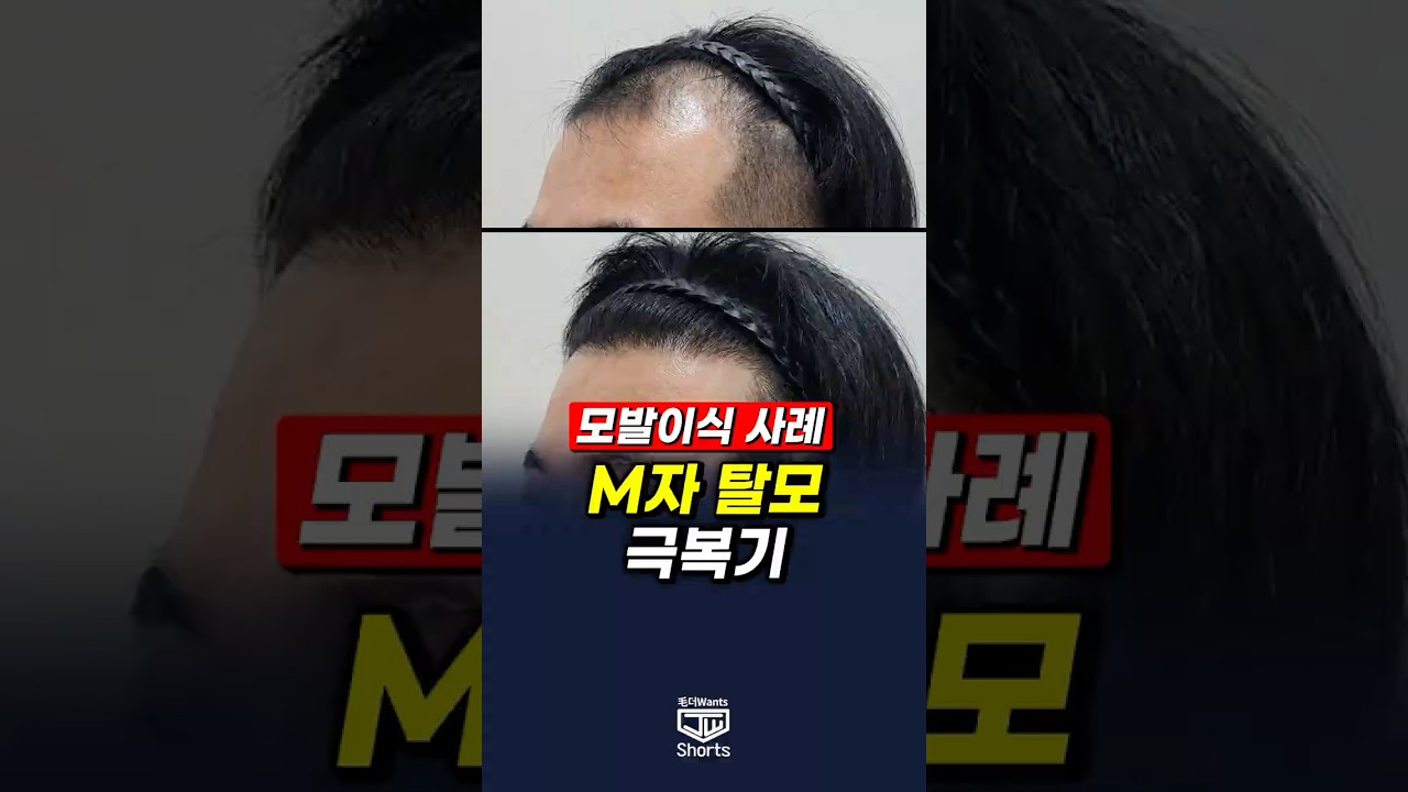 더원츠의원 숏폼