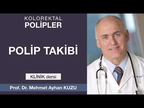 Kolorektal Polipler - Polip Takibi