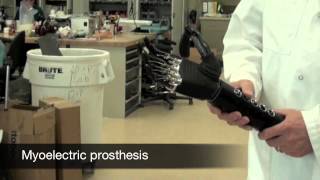 Prosthetist- Career Spotlight