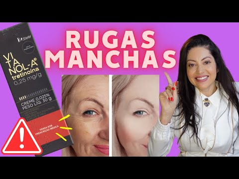 Vitanol-A Vitacid Tretinoína: Clareia Manchas, Reduz Rugas e Combate Acne! Como Usar?