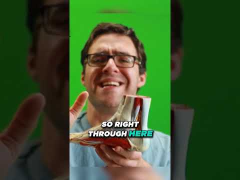 Why Is My Sprained Ankle Still Swollen After 3 6 or 12 MONTHS