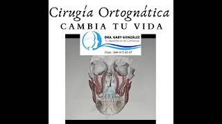 Maxilofacial en Saltillo Cirugía Ortognática  - Laura Gabriela González Valdez