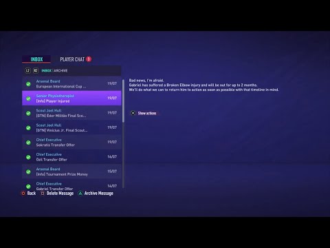 FIFA 21 Arsenal Career Mode Ep03. OMG!! We Lost Our Best Defender For 2 Months!!!