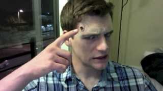 Halloween Gunshot Wound