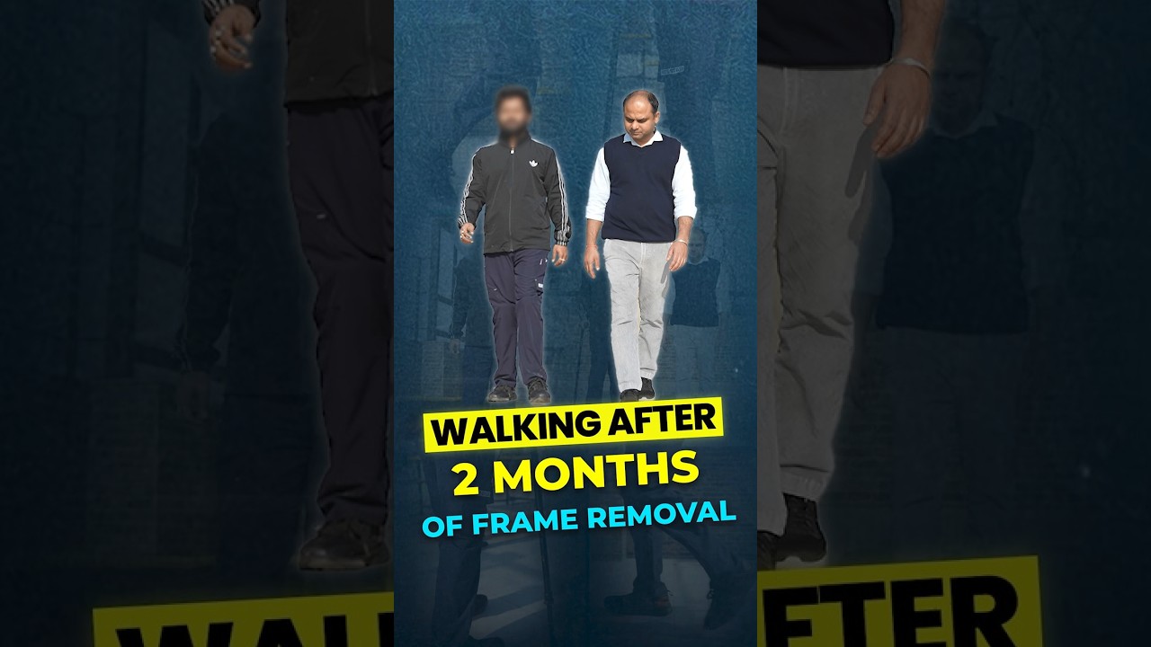 Walking After 2 Months of Frame Removal | Real Limb Lengthening Recovery at Heights Plus