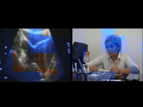 Hipnoza porno cijev