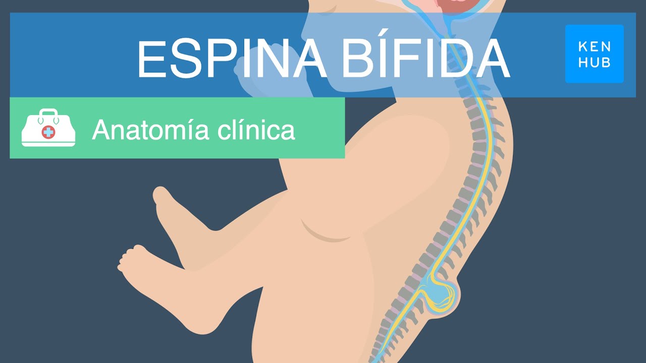 Espina bífida: Definición, causas, tipos, prevención y tratamiento | Kenhub