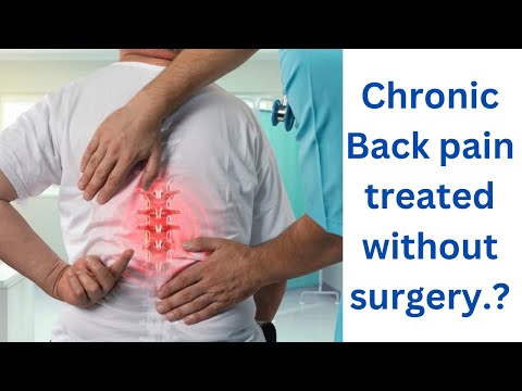 Can only surgery cure chronic back pain?| Dr. Ajay Kothari