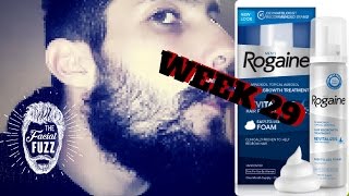 Minoxidil Beard | Week 29 | The Experiment | #Facialfuzzfridays