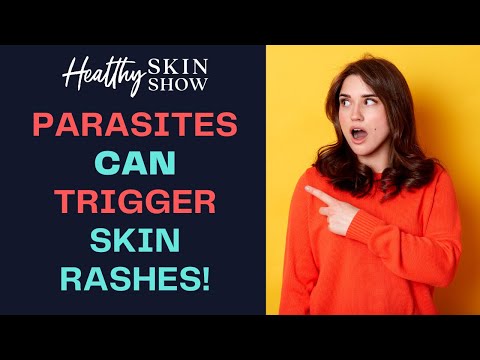Do PARASITES Cause Skin Rashes?! | Jennifer Fugo
