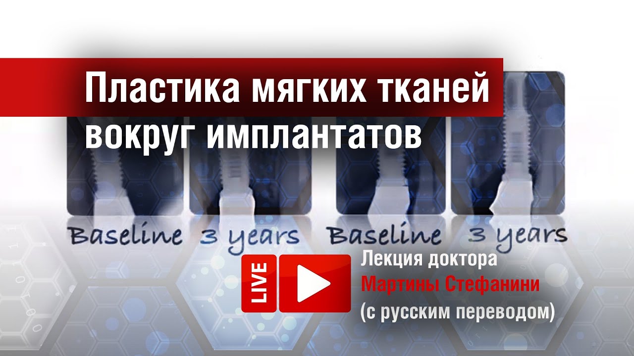 Видео