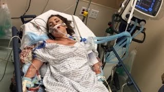 Woman Who Almost Died from Binge Drinking Posts Warning to Students