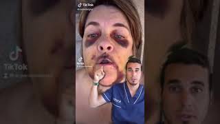 ¿POR QUÉ LE HA OCURRIDO ESTO Implantes dentales - #Shorts